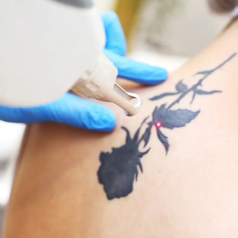 Astanza Eternity laser marketing collateral